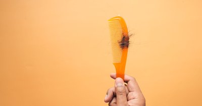Vitamin-D-Mangel und Haarausfall