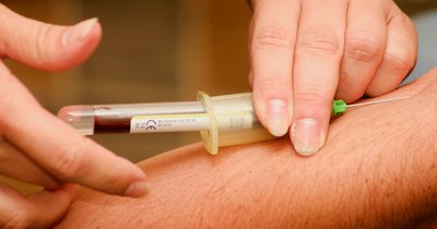 Vitamin-D-Mangel Test