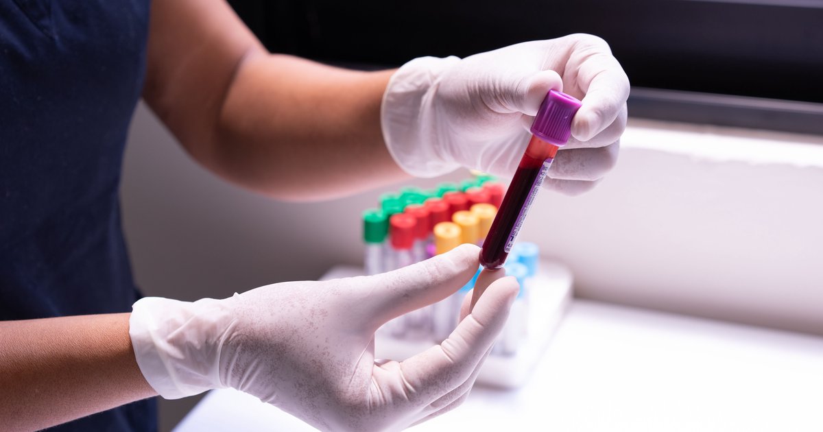 Non-HDL-Cholesterin zu hoch: Was tun
