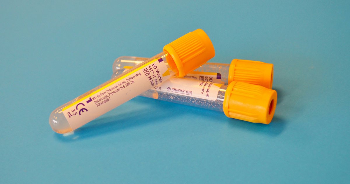 Mangel an Vitamin D: Ursachen und Folgen