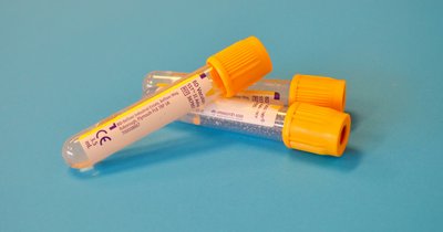 Mangel an Vitamin D: Ursachen und Folgen
