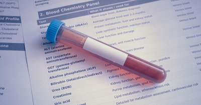 Vitamin D-Mangel: Diagnose und Therapie